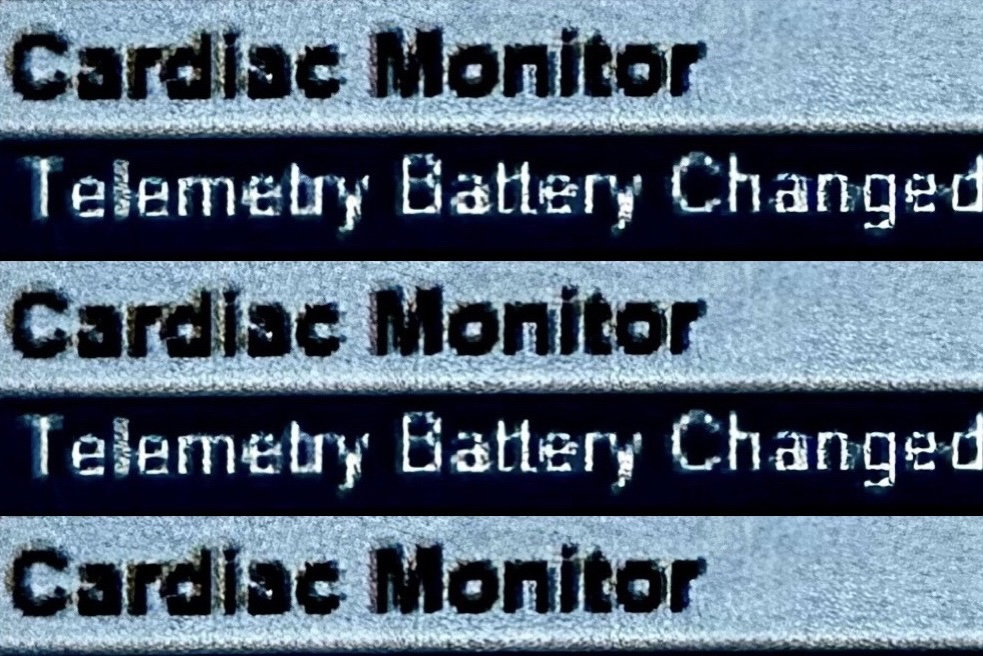 Cardiac Monitor Telemetry Battery Changed